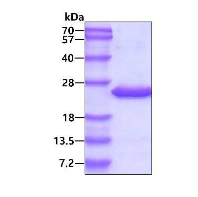 SDS-PAGE: Recombinant Human GRP His Protein [NBP1-72445]